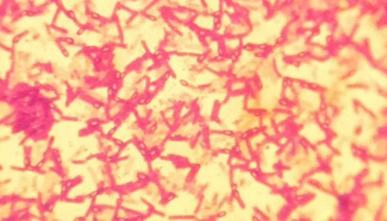 嗜酸乳杆菌的功效与用途及使用方法！