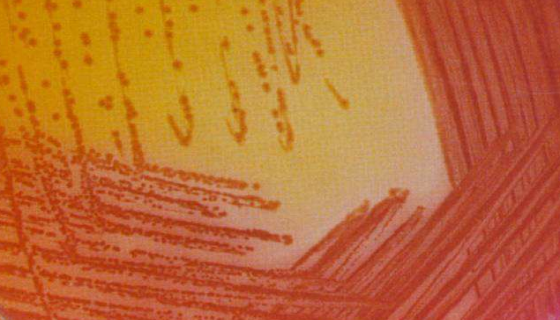 ATCC 49701 产气肠杆菌——薄膜滤器试验