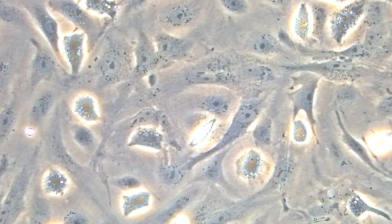 小鼠肝窦内皮细胞的背景与应用！