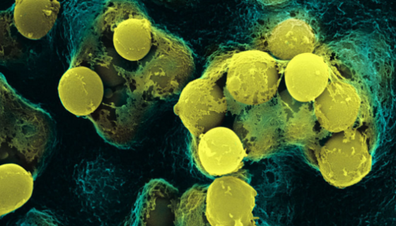 ATCC 43241 巴氏甲烷八叠球菌 百欧博伟生物