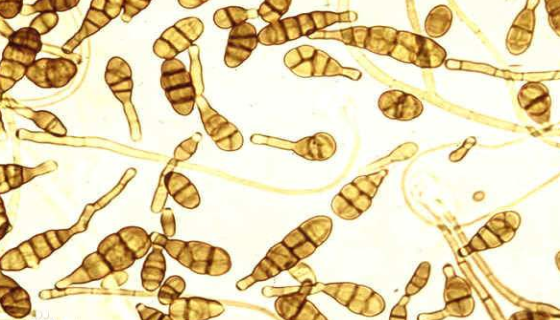 优洛菌素链霉菌的形态特征与主要价值及注意事项！