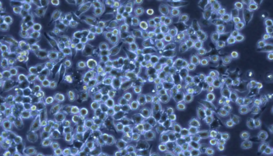 小鼠骨髓瘤细胞接收后的处理与培养步骤！