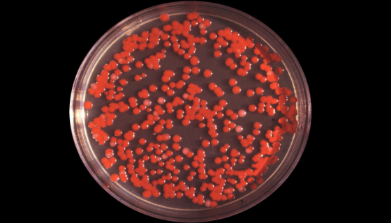 纽约杜博西氏菌的培养方法与注意事项！