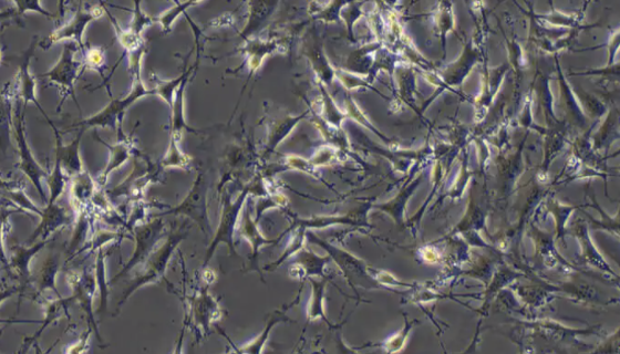 小鼠心肌细胞系的培养步骤与处理方法！