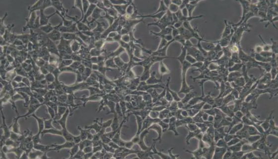 人胚肾细胞的背景与应用及复苏操作步骤！