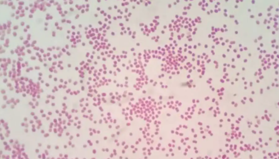 ATCC 49139 不动杆菌属单层冻干管打管说明书！