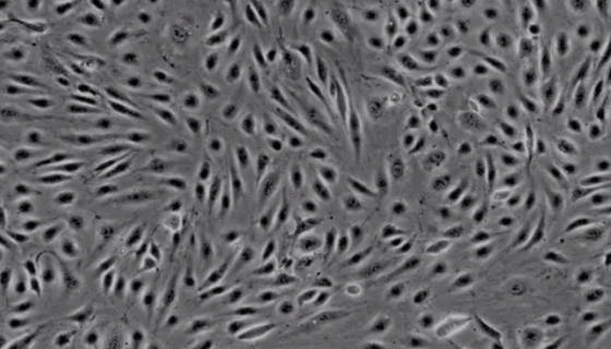 人脑微血管内皮细胞的背景与应用及培养方法！