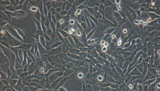 MIHA人正常肝细胞的处理方法与培养步骤！