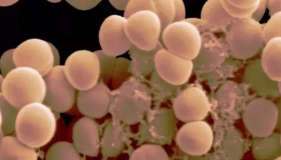 表皮葡萄球菌的细胞形态和生物化学及鉴定方法！