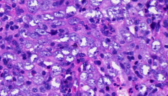 CNE1人鼻咽癌细胞接收后的操作流程与注意事项！