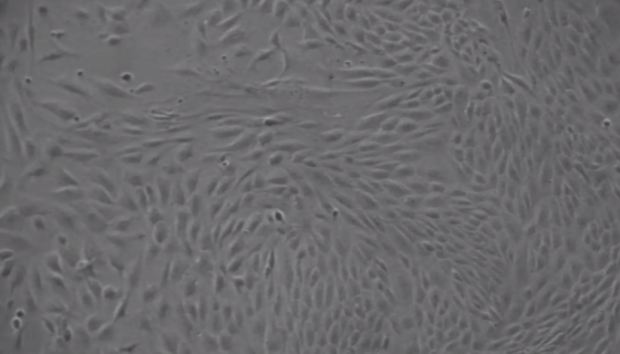 MCMEC小鼠心脏微血管内皮细胞的培养步骤与处理方法！