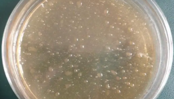 纳豆芽孢杆菌的功能功效及应用与食用方法！