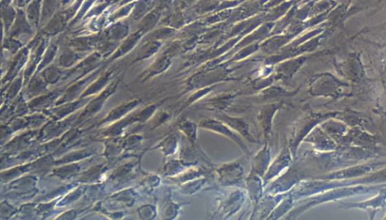 人软骨细胞C-28I2验收时的注意事项有哪些？