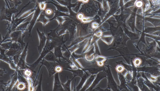 绵羊肺成纤维细胞的处理方法与培养步骤！