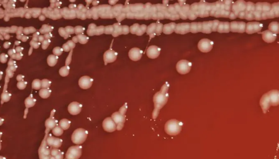 乙型副伤寒沙门氏菌的主要价值与培养方法！