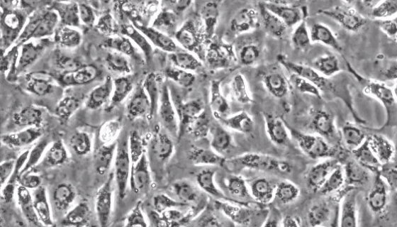 人肺泡上皮细胞的背景与概述及相关研究！