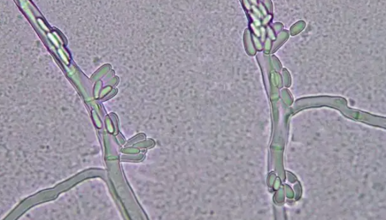 阿氏丝孢酵母的培养方法与注意事项及打管说明！