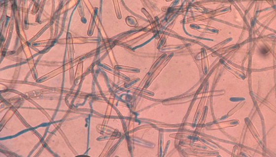 葡萄牙棒孢酵母的培养条件与注意事项及保藏方法！