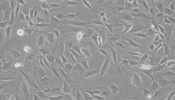 NIH/3T3小鼠胚胎成纤维细胞的培养与处理方法！