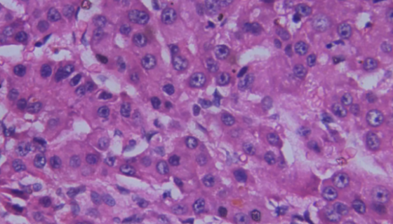 人肝癌细胞亚型的处理方法与培养步骤及注意事项！