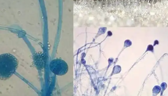 ATCC 8664 浅紫灰链霉菌浅紫灰亚种知识解析！