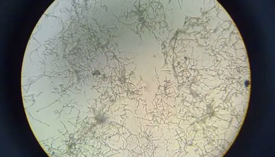 原始编号：IFO 14064奇迹束丝放线菌打管说明！
