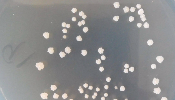 嗜热淀粉芽孢杆菌的形态特征与主要价值！