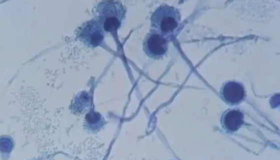 异常汉逊酵母——用于浓香型白酒酿制研究