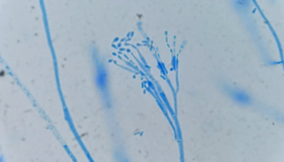 宛氏拟青霉的培养方法与使用范围及注意事项！