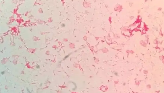 ATCC 33624 牙龈二氧化碳噬纤维菌 BIOBW生物