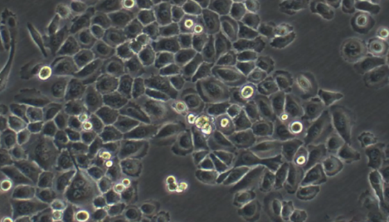 CAL-27人舌鳞癌细胞的处理方法与培养操作规程！