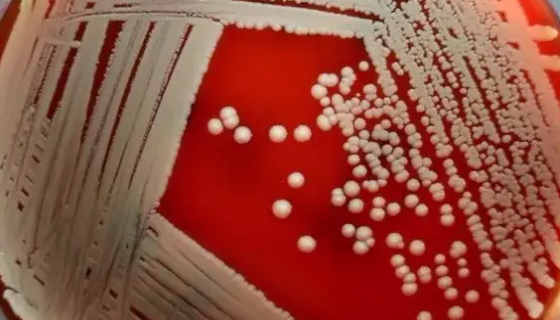 溶血葡萄球菌的致病物质与免疫性质及鉴别要点！