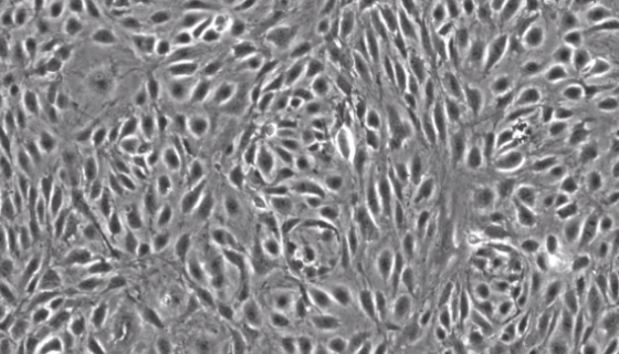 EC-304人血管内皮细胞的处理与培养及主要用途！