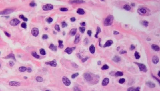 LAD2人肥大细胞收到后的处理方法与培养步骤！