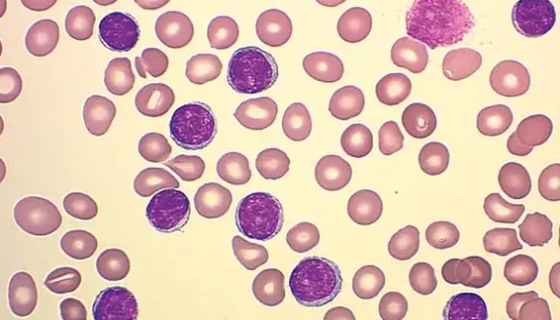 人急性原粒细胞白血病细胞培养的优点与操作步骤！