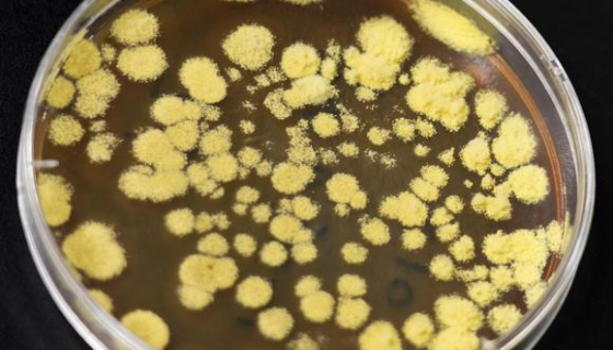 蜡叶散囊菌的培养条件与注意事项及打管说明！