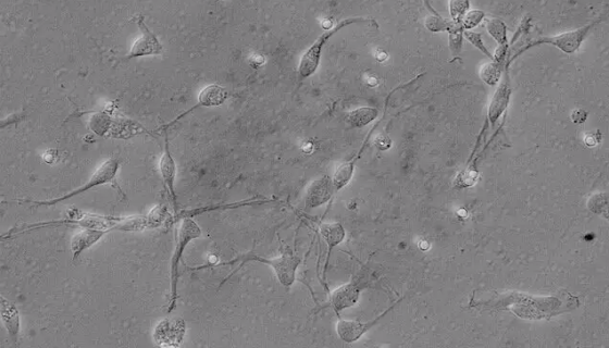 人真皮毛乳头细胞的运输和保存及使用方法！