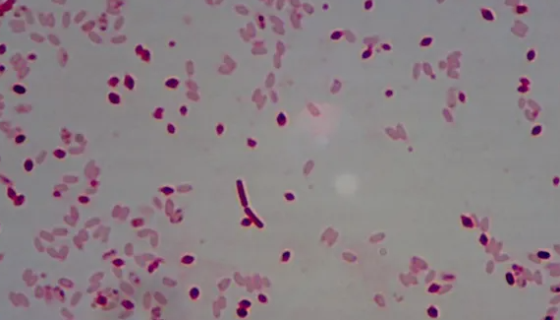 苏云金芽孢杆菌的实验内容与注意事项及保藏方法！