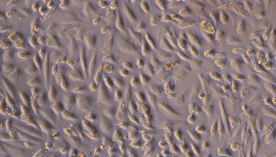 小鼠膀胱上皮细胞接受后的处理方法与培养操作规程！