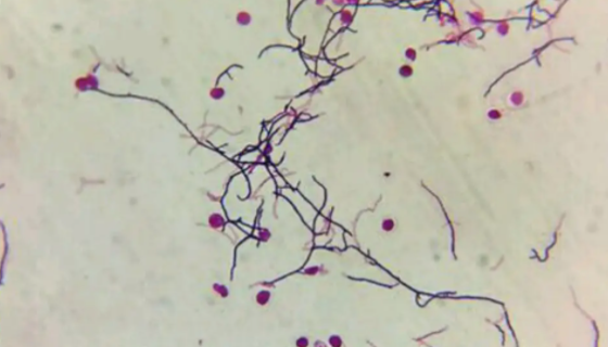 ATCC 11874 肉桂链霉菌的培养方法与注意事项！