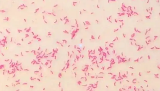 费氏另类弧菌的形态特征与主要价值及打管说明！