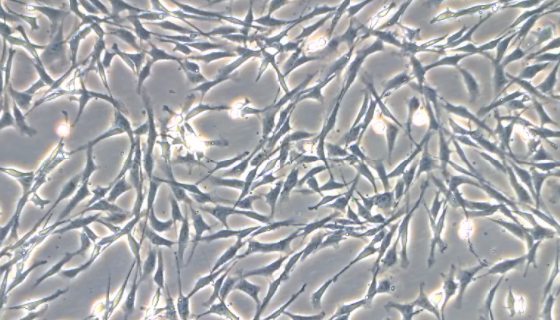 MIO-M1视网膜Muller干细胞的消化与传代及处理方法！