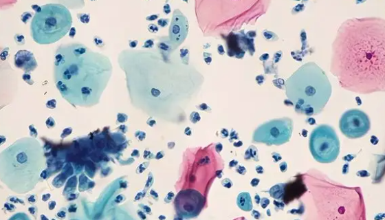 人阴道上皮细胞收到后的处理方法与培养步骤！