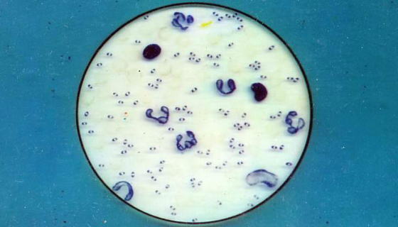 巴氏醋杆菌攀升亚种冻干管打管说明书！