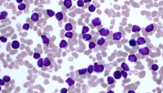 依赖性淋巴母细胞小鼠白血病细胞的培养步骤！