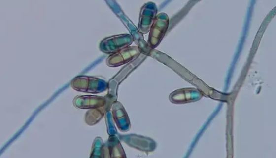 德尔布有孢圆酵母——用于白酒酿造和产淀粉酶