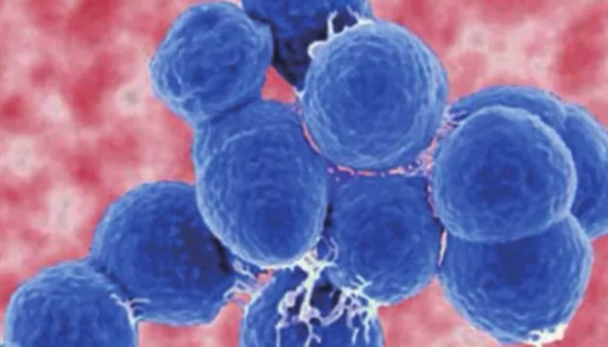 肺炎链球菌之常引起疾病及其治疗策略！