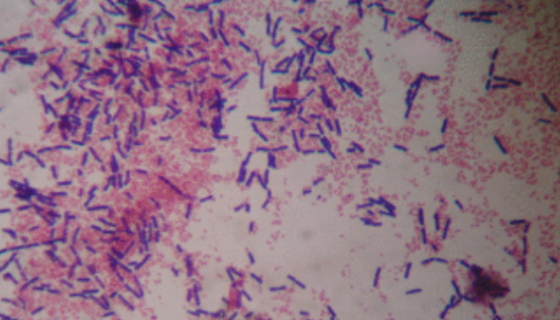 ATCC 19402 诺氏梭菌的知识解析及注意事项！