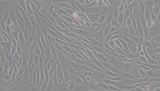 HUVEC细胞的背景与应用及实验操作步骤！