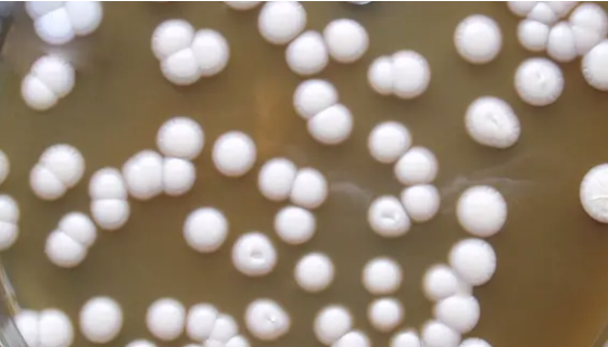 柱形假丝酵母的特点与优势及培养方法！